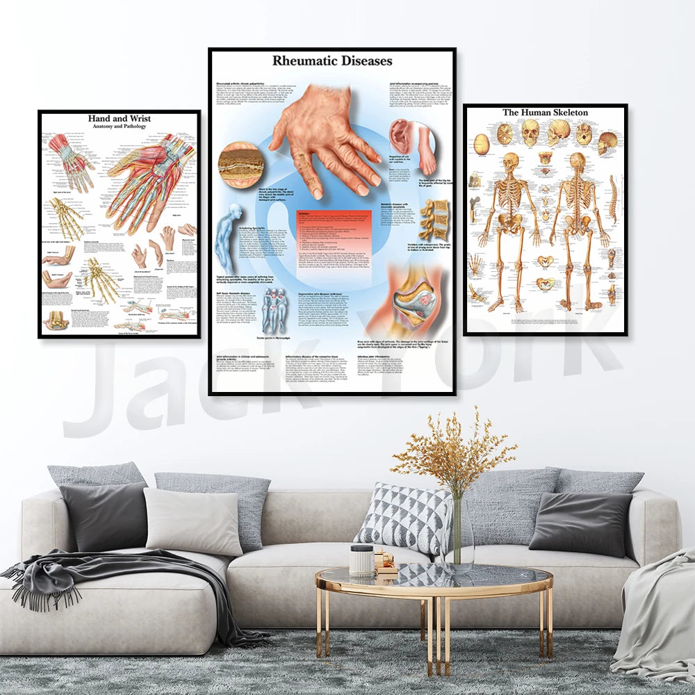 Cette image est composée de trois tableaux explicatifs sur les maladies rhumatismales, les mains et les poignets, ainsi que le squelette humain, fournissant des informations anatomiques et médicales détaillées.