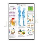 Cette image informative présente les différents aspects de l'ostéoporose, notamment la structure microscopique des os, les processus de maintien osseux, les changements physiques et les traitements liés à cette maladie.