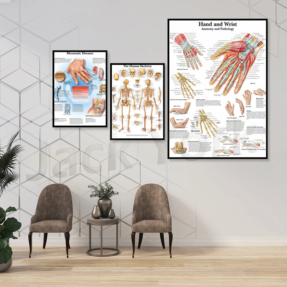 Cette image montre une collection d'affiches médicales illustrant l'anatomie et la pathologie de la main et du poignet, ainsi que le squelette humain.