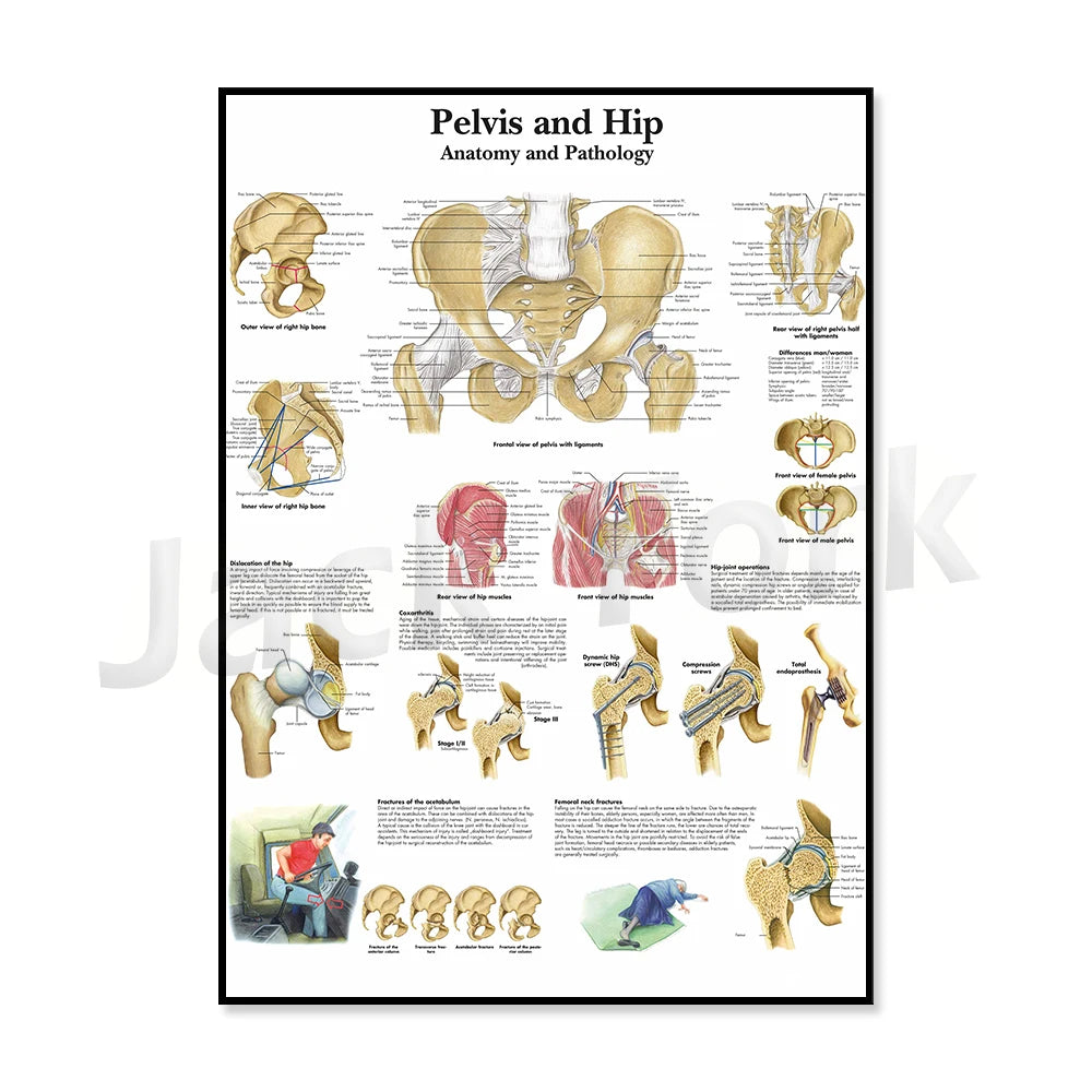 Cette affiche anatomique détaille la structure et les pathologies du bassin et des hanches, présentant de nombreuses vues et schémas explicatifs.