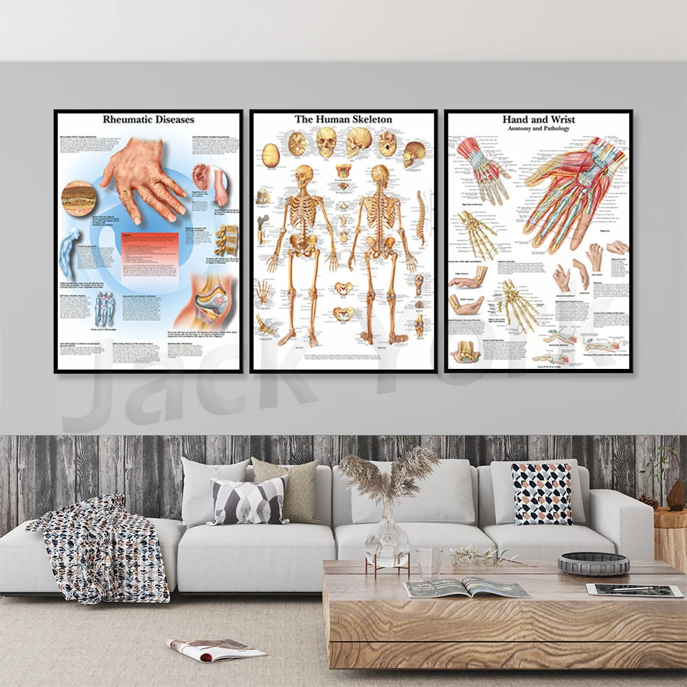 Affiches médicales montrant l'anatomie des mains et du squelette humain, ainsi que les maladies rhumatismales.