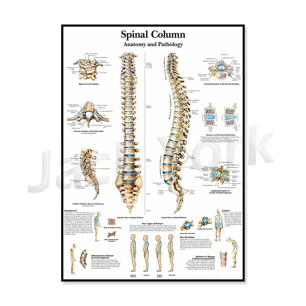 Cette image détaillée présente l'anatomie et la pathologie de la colonne vertébrale, illustrant les différentes vertèbres, les types de posture, ainsi que divers problèmes de santé associés à la colonne vertébrale.