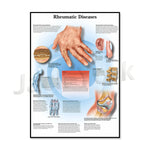 L'image est un poster médical illustrant les différentes maladies rhumatismales, telles que l'arthrose, la polyarthrite rhumatoïde et la goutte, avec des informations détaillées sur leurs symptômes et leurs effets sur le corps.