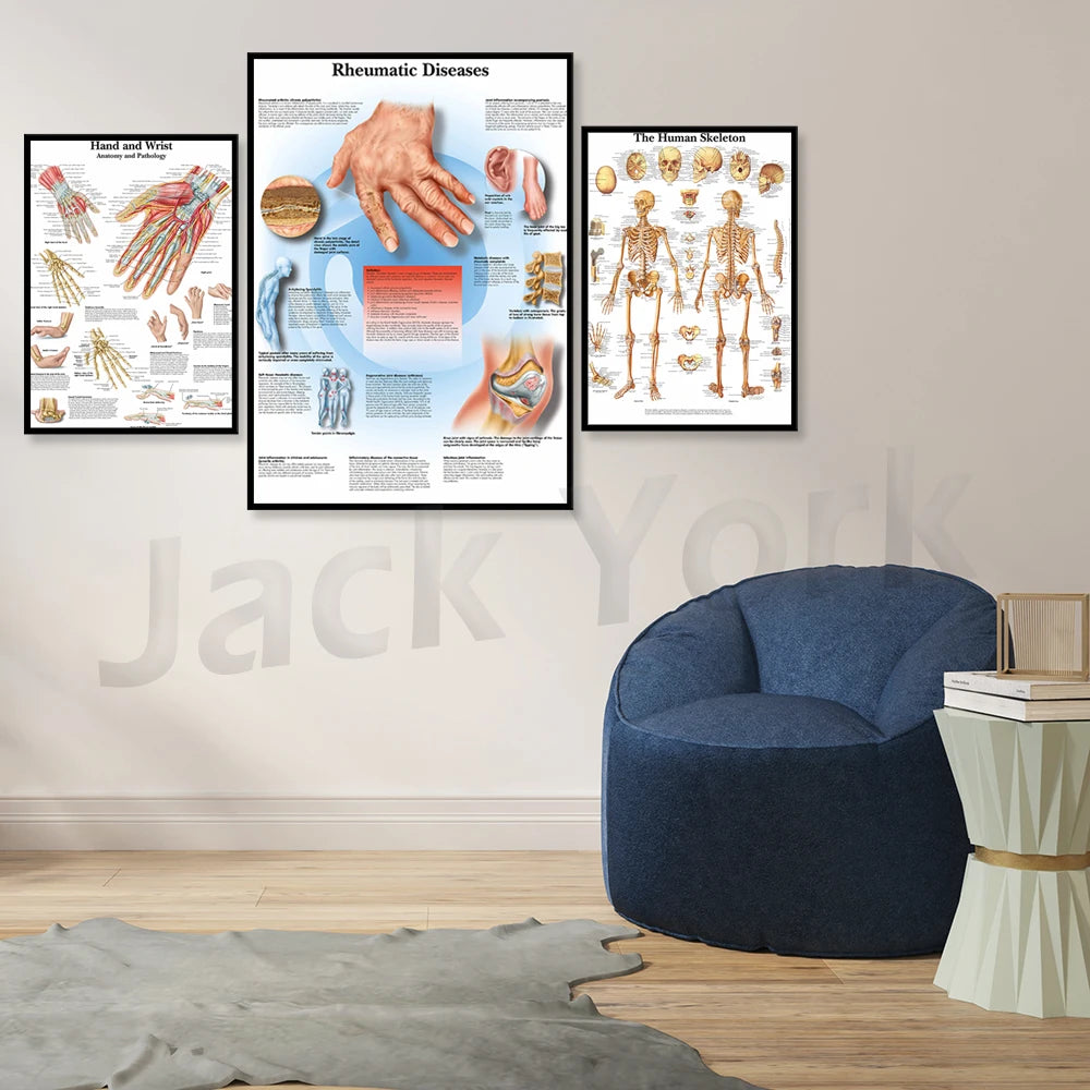 Cette image montre trois affiches médicales accrochées au mur, abordant des sujets liés à la santé et à l'anatomie, notamment les maladies rhumatismales, l'anatomie de la main et du poignet ainsi que le squelette humain. Un fauteuil bleu moderne est placé au premier plan, sur un sol en bois clair.